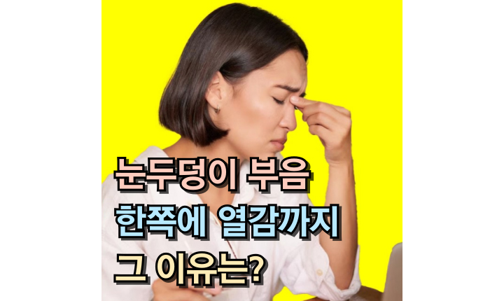 Read more about the article 눈두덩이 부음 이유! 한쪽에 열감까지 느껴진다면